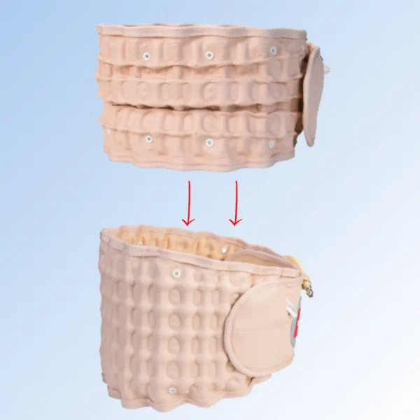 decompression belt height expansion before and after inflation comparison